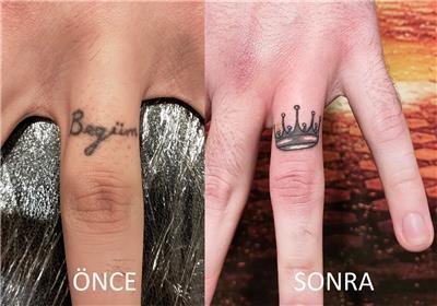 parmak-uzeri-isim-tac-dovmesi-ile-kapatma---finger-tattoo-cover-up-with-crown-tattoo