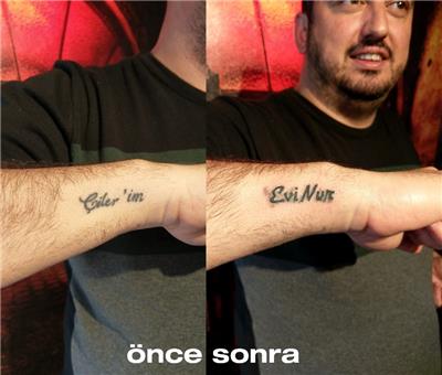 isim-dovmesi-silme-kapatma-calismasi---name-tattoo-cover-up