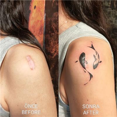 koi-baligi-dovmesi-ile-yara-izi-kapatma---scar-covering-with-koi-fish-tattoo