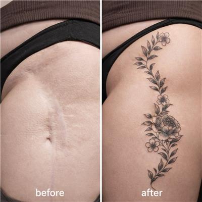 bacak-kesik-yara-izi-uzerine-cicek-yaprak-dovmeleri