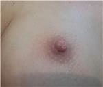 estetik-amacli-meme-ucu-dovmesi---nipple-areola-tattoo