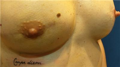 mikropigmentasyonla-rekonstruksiyon-meme-ucu-dovmesi---nipple-areola-tattoo
