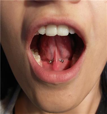 frenulum-dil-alti-piercing---frenulum-under-tongue-piercing