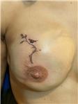 mikropigmentasyonla-rekonstruksiyon-meme-ucu-dovmesi---nipple-areola-tattoo