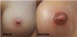 estetik-amacli-meme-ucu-dovmesi---nipple-areola-tattoo