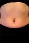 titanyum-gobek-piercing---titanium-navel-piercing