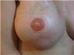 meme-ucu-dovmesi---nipple-areola-tattoo