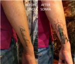 batuhan-isim-kol-dovmesi-deniz-feneri-ile-kapatma---name-tattoo-cover-up-with-lighthouse-tattoo