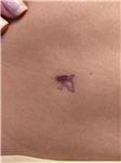 kus-dovmeleri-ile-ameliyat-izi-kapatma---birds-scar-cover-tattoos