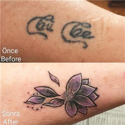 cicek-dovmesi-ile-isim-dovmesi-kapatma-calismasi---name-tattoo-cover-up-with-flower-tattoo