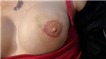 meme-ucu-dovmesi---nipple-areola-tattoo