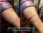 ok-dovmesi-ile-yara-kesik-izi-kapatma-calismasi---arrow-scar-tattoos