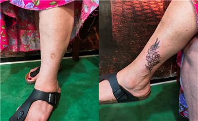 yara-izi-uzerine-cicek-dovmesi---flower-tattoo-on-scar