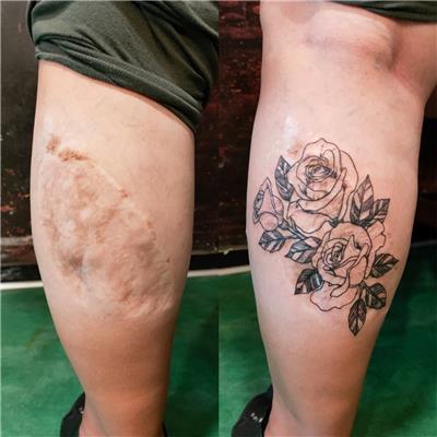 bacak-ameliyat-izi-uzerine-gul-dovmesi---scar-tattoo