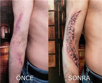 kol-yara-izi-uzeri-dovme-ile-kapatma---scar-tattoo