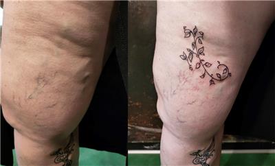 varis-uzerine-sarmasik-dovmesi---varicose-vein-ivy-tattoo