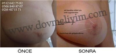 meme-ucu-dovmesi---nipple-areola-tattoo