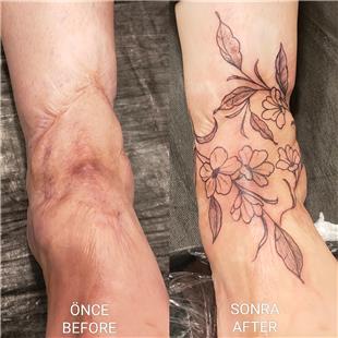 Ayak zerine iekler le Yara zi Kapatma almas / Foot Scar Tattoo