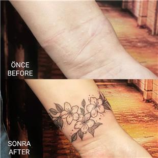 iek Dvmesi ile Kesik zi Kapatma almas / Scar Tattoo