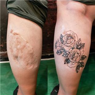 Bacak Ameliyat İzi Üzerine Gül Dövmesi / Scar Tattoo