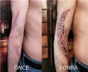 Kol Yara zi zeri Dvme ile Kapatma / Scar Tattoo